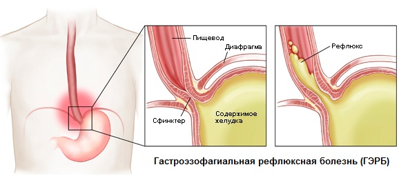 ГЭРБ