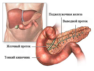 Панкреатит - симптомы, диагностика, лечение